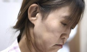 “少女身，老人脸”！一场百万分之一的“命运捉弄”